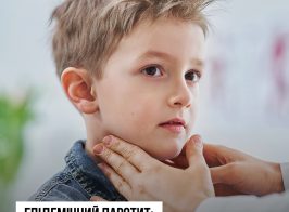 На сайт щеплення (3)